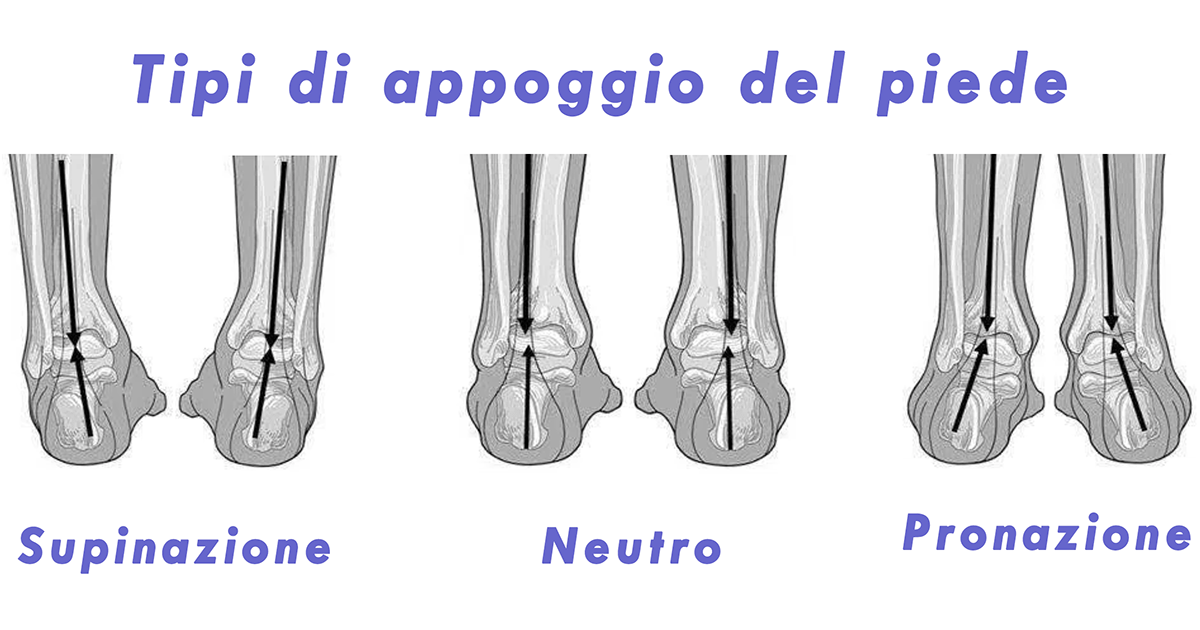 Scelta delle scarpe da running per appoggio del piede e postura corporea come scegliere le scarpe per correre per appoggio del piede