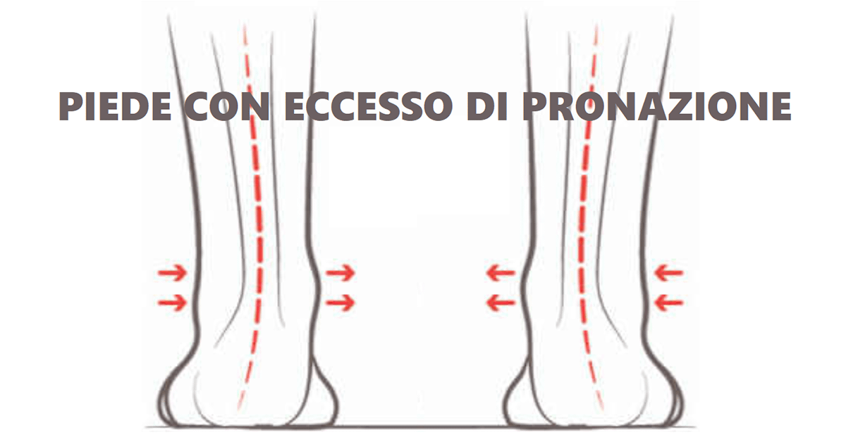 Calzature protettive con sostegno per arco plantare piede piatto e pronazione del piede